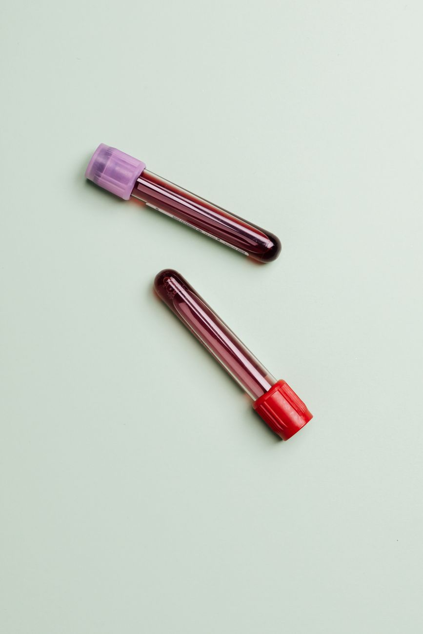Blood sample tubes representing blood type testing